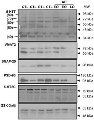 Glycosylation States of Pre- and Post-synaptic Markers of 5-HT Neurons Differ With Sex and 5-HTTLPR Genotype in Cortical Autopsy Samples